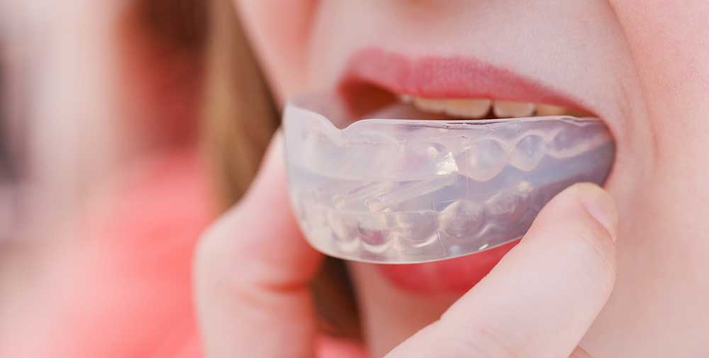 Imatge - Protector buco-dental